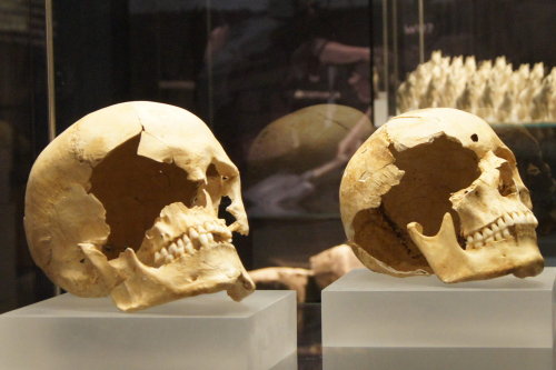 Antike Schädel, Kriminalität  im Römischen Reich. Foto: jvf / Rechte: LVR-RömerMuseum Xanten